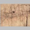 Neuronas Golgi 07.jpg